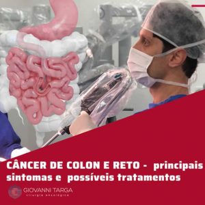 cancer de colon e reto em São Paulo tratamentos