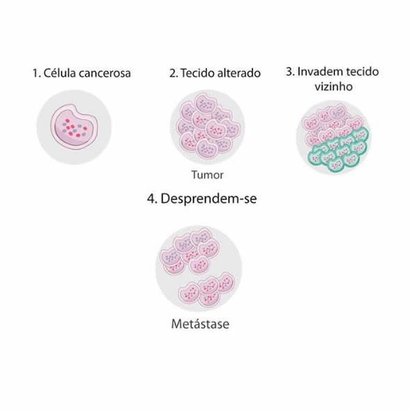 como o cancer se desenvolve no organismo células