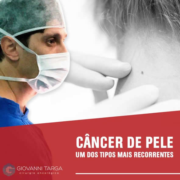 tratamento do cancer de pele em São Paulo